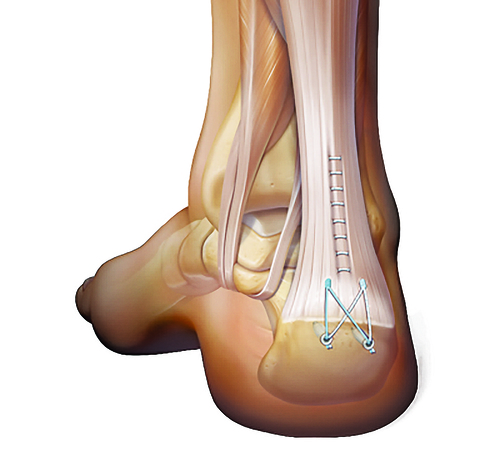 Fig-2.jpg